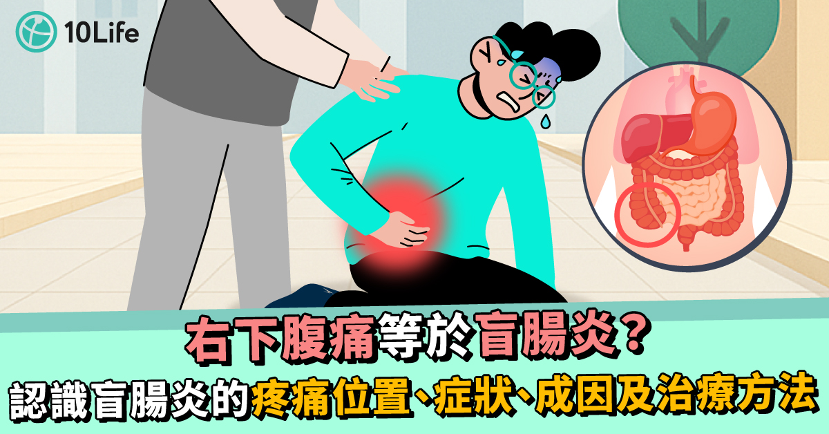 盲腸炎