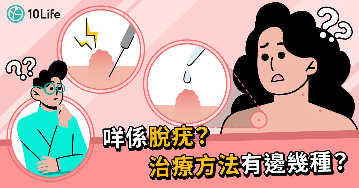 【脫疣價錢2023】5種脫疣治療有咩分別？拆解Claim保險注意事項